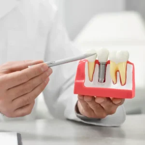 implan-gigi-harga-rp15juta-klinik-docden Berapa Harga Implan Gigi di 2025? Mulai Rp 15 Juta/Gigi